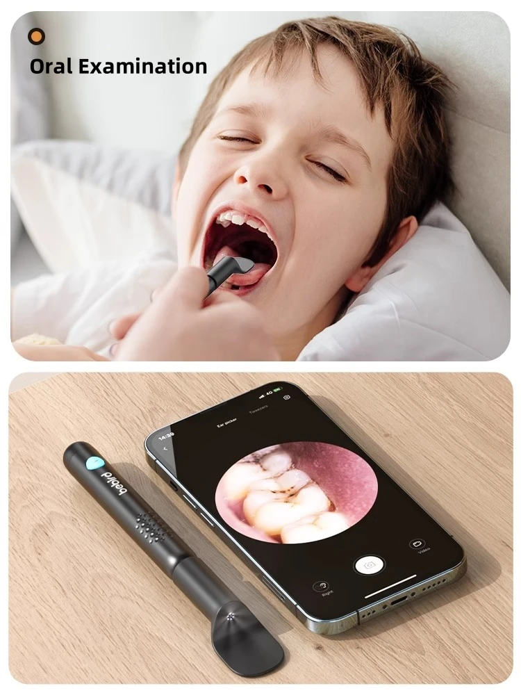 Bebird R3 Ear Cleaner Smart Vi - đánh giá và giá Pet Ear Cleaner